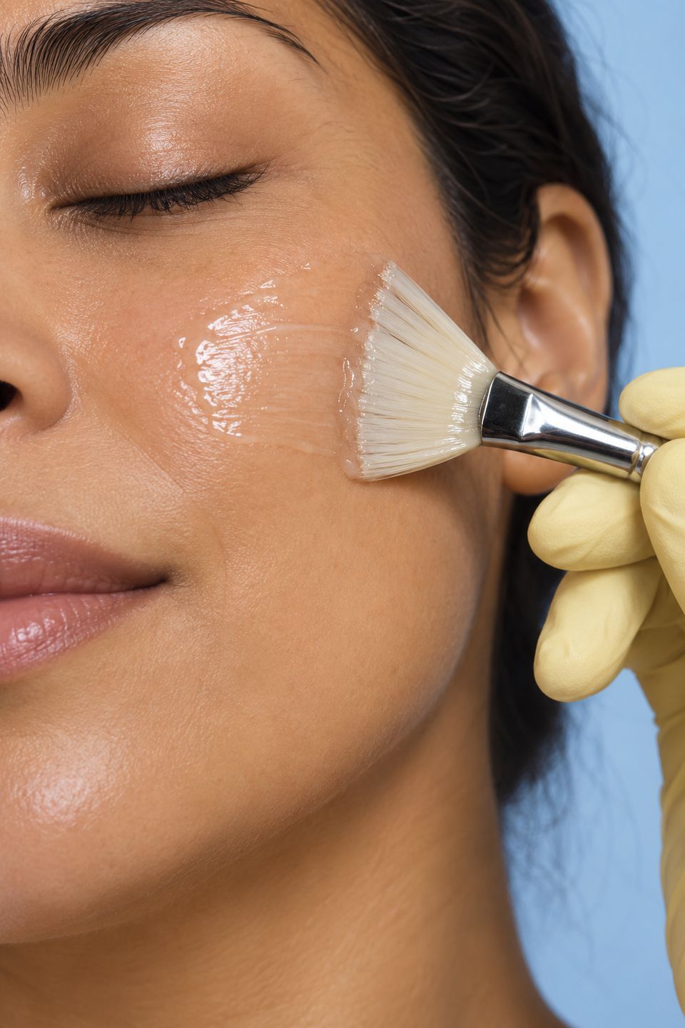 Illustrative editorial photo for the guide: Chemical peels in Buckeye